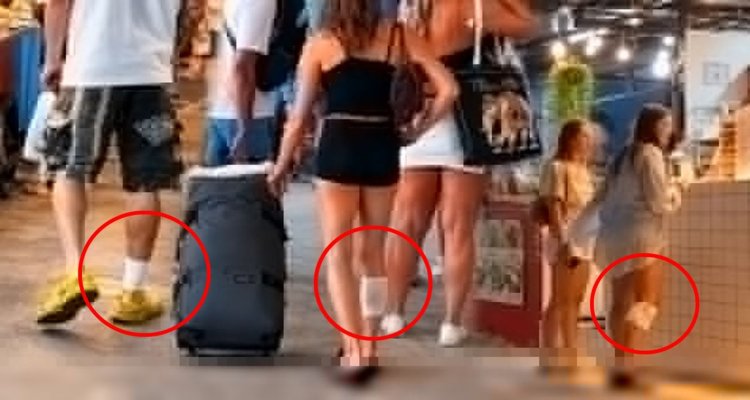 Турист был крайне удивлен в Таиланде, увидев на улицах много людей с забинтованными правыми ногами